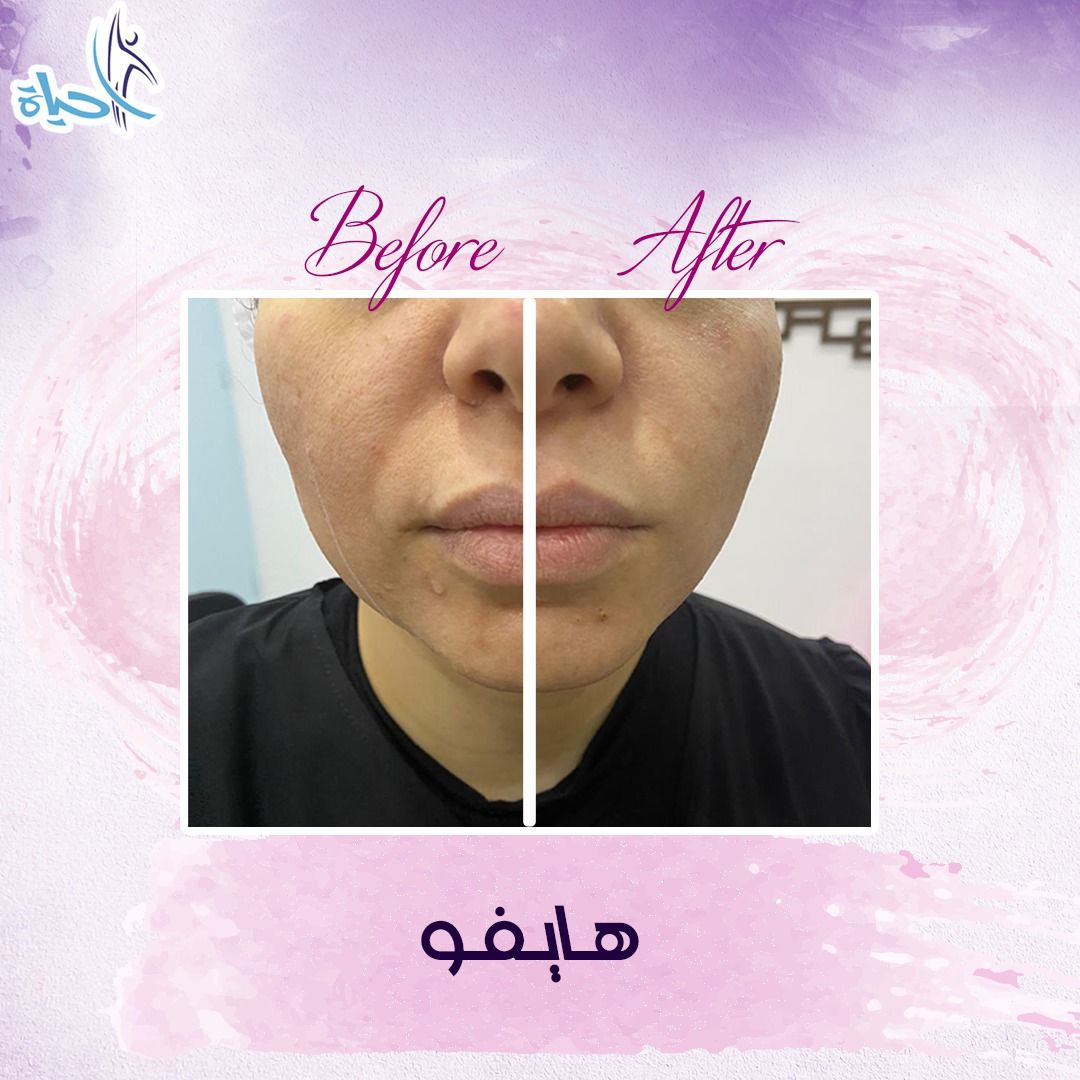 Expert Team Member 24