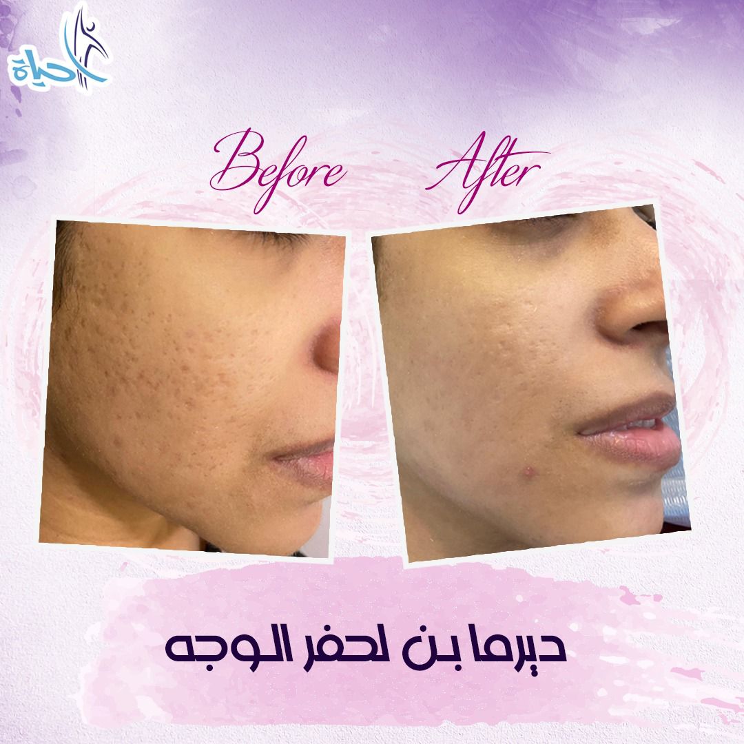 Expert Team Member 25