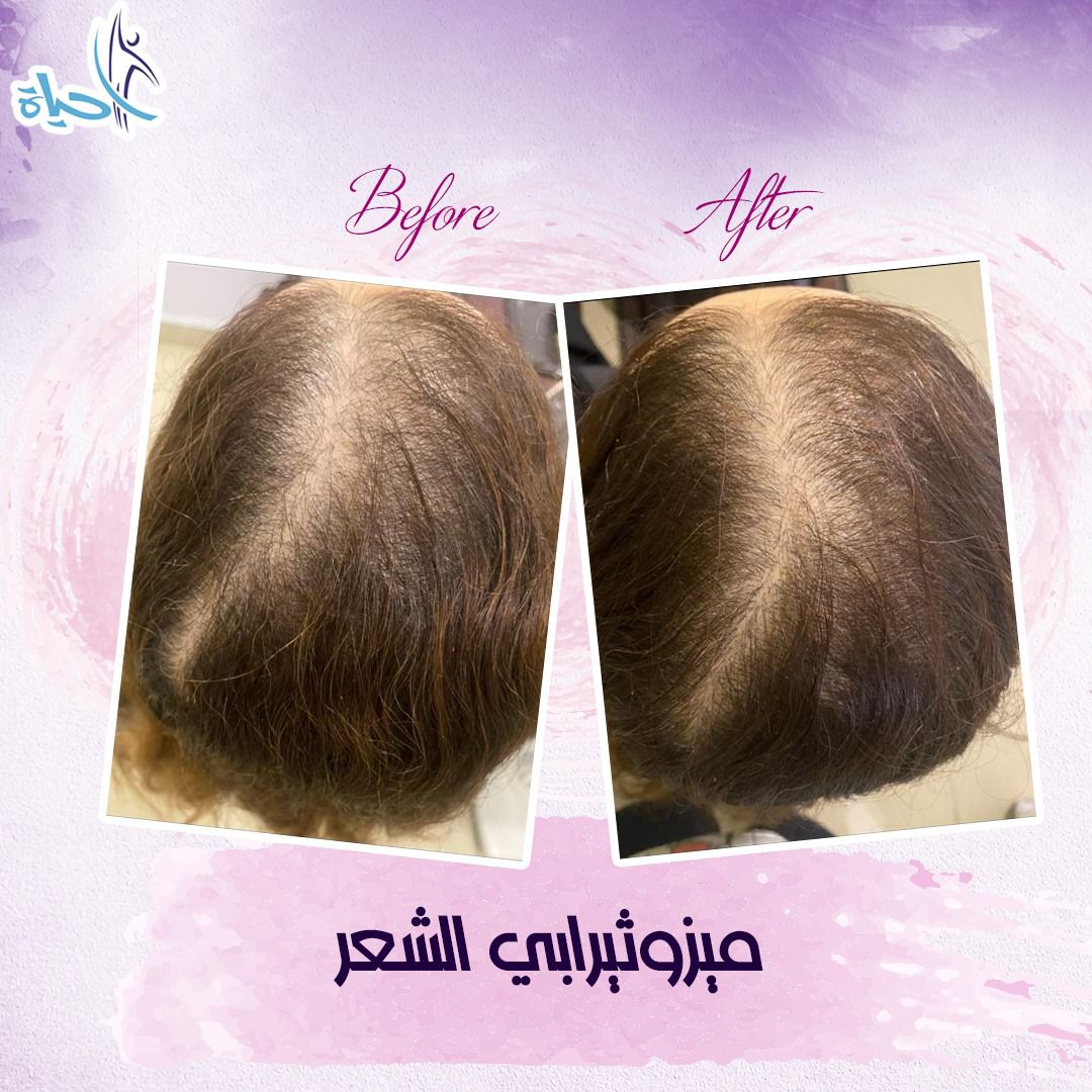 Expert Team Member 26