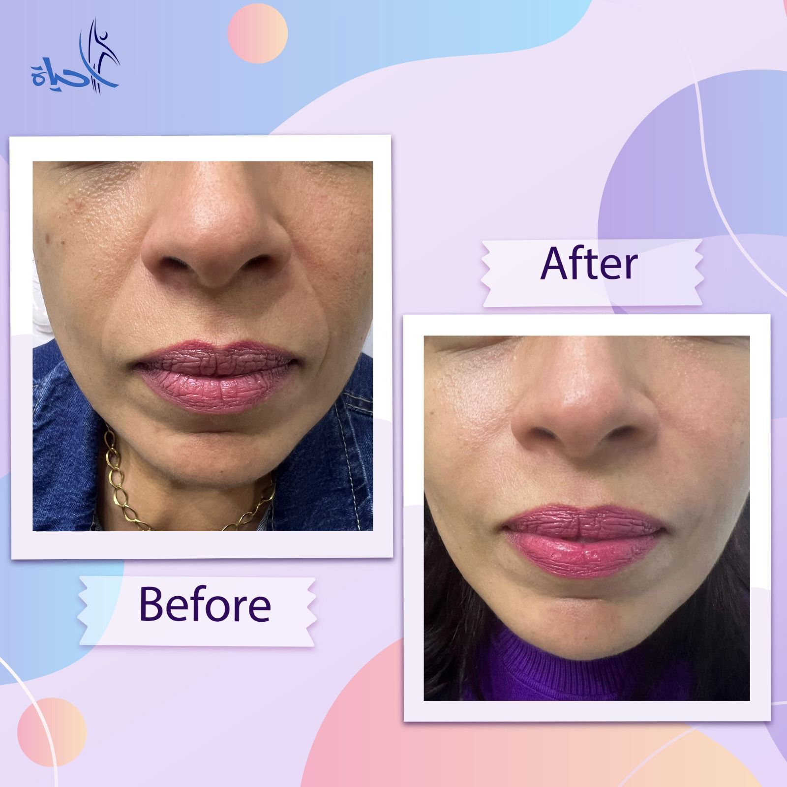 Expert Team Member 28